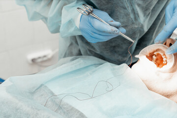 Patient and dentist during implant placement operation. Real operation. Tooth extraction, implants. Professional uniform and equipment of a dentist. Healthcare Equipping a doctor&rsquo;s workplace. 