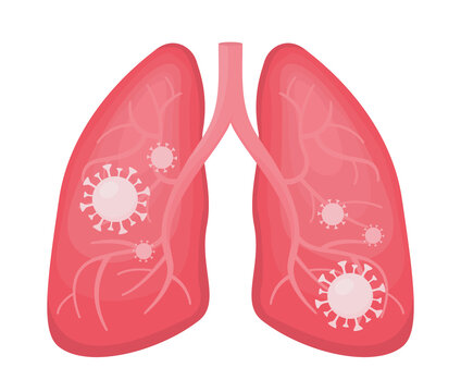 Flat vector illustration of human lungs infected with coronavirus or viral pneumonia and covid. Pandemic impact on your health, virus cells, detail outline of anatomy organ isolated.