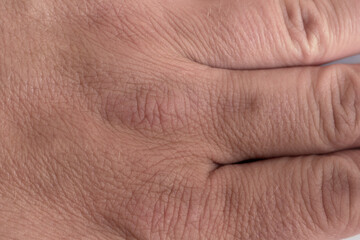skin texture of the hands of a white man 37 years old. wrinkles. cosmetology and dermatology. hand care. High saturation