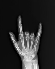 rock the goat is a symbol of rock music on the x-ray brushes