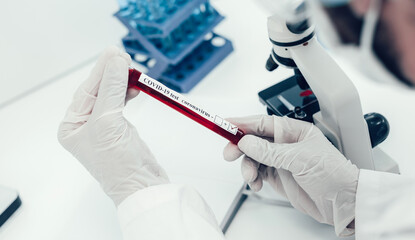 close up. scientist reading the inscription on the tube with the test.