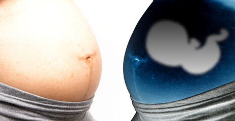 Close up of pregnant woman touching her belly,
 Graphic infant ultrasound concept