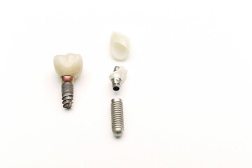 Dental implant of a human tooth and its parts on a white background