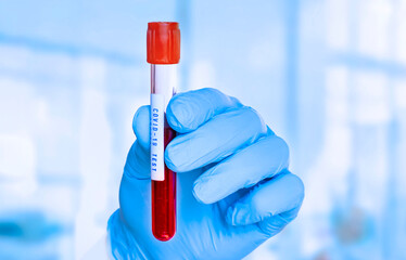 Doctor holding a test tube with blood sample for COVID-19 SARS-CoV-2 Lab test. (Shallow DOF)
