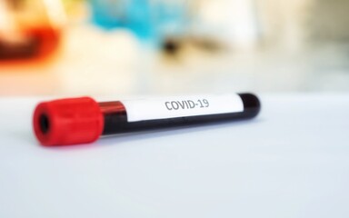 Obraz premium Blood sample in test tube for COVID-19 analyzing. Diagnosis and examination of coronavirus or covid-19 tests have positive or negative results.
