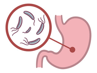 胃に潜むピロリ菌を表したイラストレーション