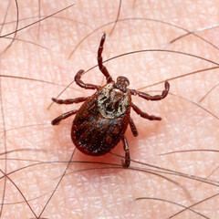 Mite crawling along a human skin with hair macro