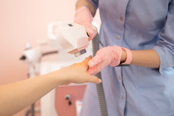 Laser removal of dark hair from hands of young woman. Epilation Skin care concept