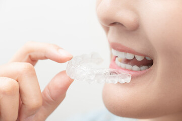 Woman wearing orthodontic silicone trainer. Mobile orthodontic appliance for dental correction....