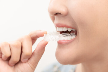 Woman wearing orthodontic silicone trainer. Mobile orthodontic appliance for dental correction....