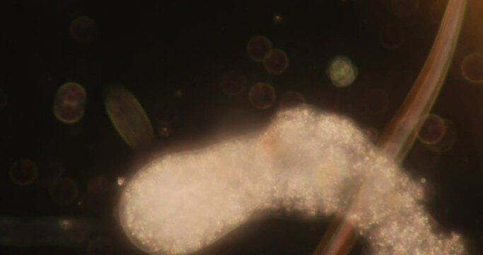 Amoebae move and feed by using pseudopods, which are bulges of cytoplasm formed by the coordinated action of actin microfilaments pushing out the plasma membrane that surrounds the cell.
