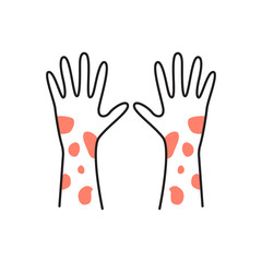 Skin rash  irritation on hand. isolated on white background