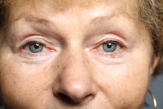 Tired look an elderly woman European appearance. Close-up, smiling face woman. Female face without makeup and intervention plastic surgeon. Correction defects. Microblading or hardware-based eyebrow