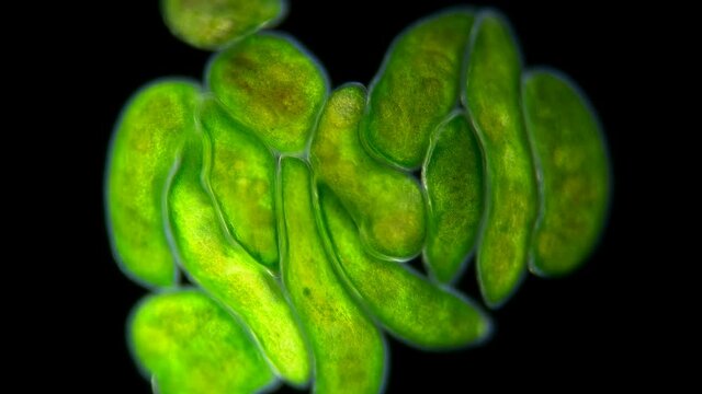 Flatworm Typhloplana sp. under a microscope, the Typhloplanidae family, Rhabditophora class, lives in symbiosis with the Zoochlorella algae, therefore they are green in color, they live in fresh water