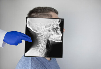 Survey radiography of a man’s skull on the side. A doctor radiologist is studying an x-ray...