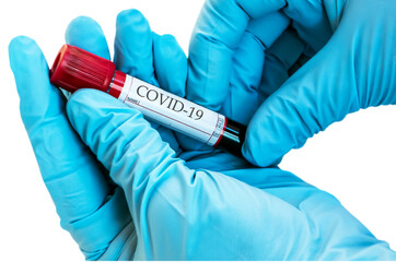 Coronavirus Blood Sample Test Tube biochemical