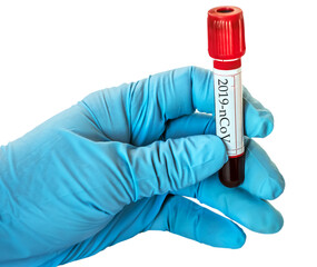 Coronavirus 2019-nCoV Blood Sample Test Tube biochemical