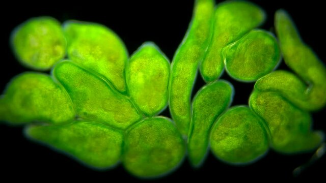 Flatworm Typhloplana sp. under a microscope, the Typhloplanidae family, Rhabditophora class, lives in symbiosis with the Zoochlorella algae, therefore they are green in color, they live in fresh water