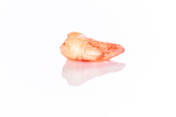 A closeup left upper third molar after extraction (Adult tooth number 28)