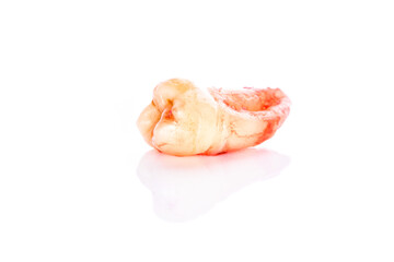 A closeup left upper third molar after extraction (Adult tooth number 28)