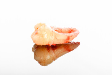 A closeup left upper third molar after extraction (Adult tooth number 28)