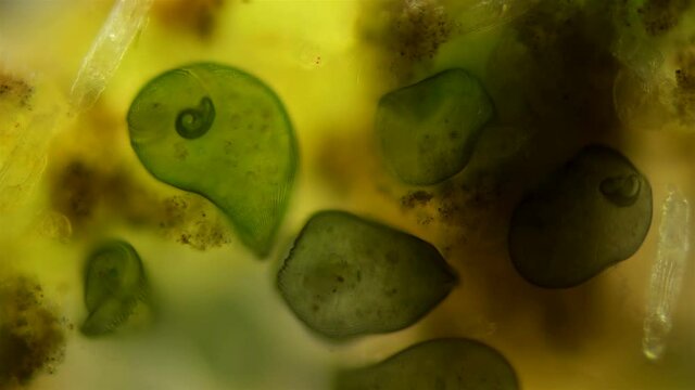 colony Infusoria Stentor under the microscope, the family Stentoridae, class Ciliata, feed on small organic residues, bacteria, algae, protozoa. Also on the video a lot of rotifers Philodina
