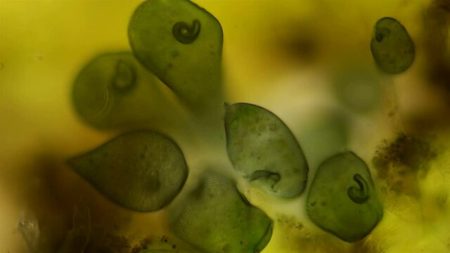 colony Infusoria Stentor under the microscope, the family Stentoridae, class Ciliata, feed on small organic residues, bacteria, algae, protozoa. Also on the video a lot of rotifers Philodina
