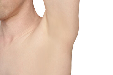 Girl underarm. White man armpit. After epilation collage. Wax depilation result concept. Laser hair...