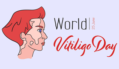 World Vitiligo Day. Young short hair girl with vitiligo pigment spots. Side view portrait of caucasian woman - Isolated vector. Female face with genetic skin problem