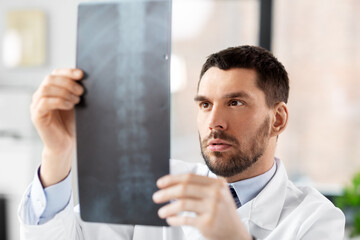 healthcare, medicine and people concept - male doctor with x-ray of spine at hospital