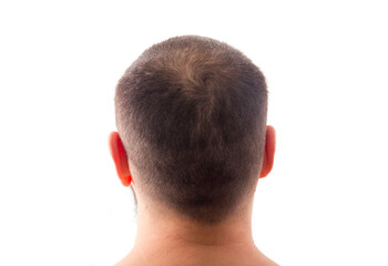 Obraz premium against hair loss