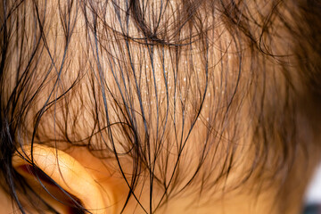 赤ちゃんの後頭部　または赤ちゃんの横顔、汗のクローズアップ