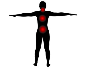 Rückansicht Frau mit Symbol für Schmerzen im Rücken