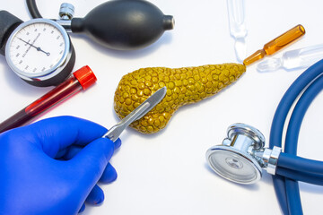 Concept photo of pancreas surgery, operation of gland resection or pancreatectomy. Doctor with scalpel in hand makes incision in figure of human pancreas, which is located near medical toolkit