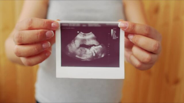 A girl with a gray t-shirt with a round belly shows the ultrasound result to the camera. A pregnant woman with a large belly holds out a photo of a baby with an ultrasound to the camera.