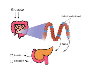 GLP-1 release by the cells of the small intestine and colon. L-cells produce glucagon-like peptide in response to glucose