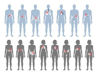 Pain in human body