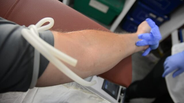 Close Up Arm Of A Man Who Donates Blood. Male Donor Gives Blood In A Mobile Blood Donation Center. COVID 19 Plasma Donation.