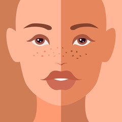 Combined woman portrait with symmetric half faces of dark and light skin. Different tones. Closeup view. Skin whitening concept. Cute cartoon avatars in natural colors. Stock vector illustration