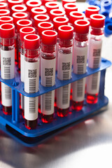 Laboratory tests - blood in glass tubes in a medical laboratory