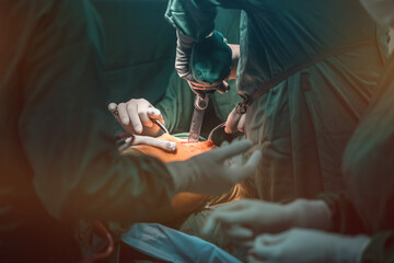 orthopedic surgery. close up hip joint and bone anatomy concept pelvis bone with ligaments where...