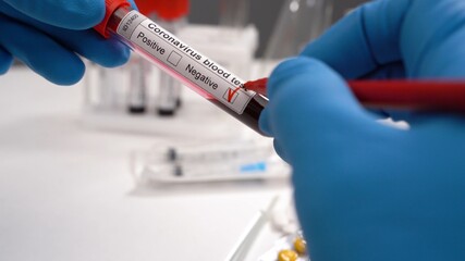 Corona negative blood test. Coronavirus COVID 19 blood test tube novel corona virus. Syringes, samples for Coronavirus COVID-19