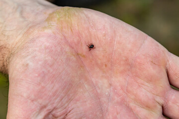 A tick crawls palm up on a hand close-up. Horizontal orientation.