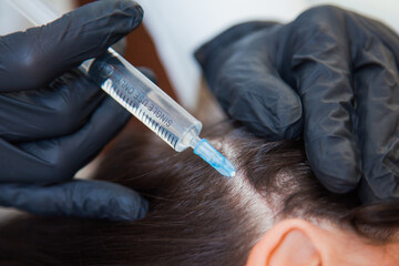 Unrecognizeble female person at trichologist office get injections in head skin. Doctor's hands...