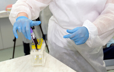 Blood donor survivor of coronavirus infection. Hand, analysis, test tubes.