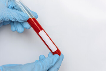 Medical worker's hand in blue glove holding vial of blood sample for laboratory analysis, close-up. Blood plasma for plasmolifting, isolated on white background. Free space for text on test tube.