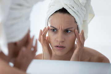 Close up unhappy woman wearing white bath towel checking skin after shower, looking in mirror,...