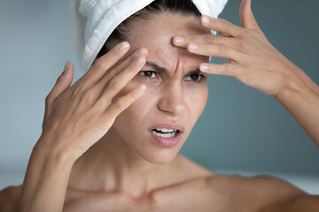 Close up angry unhappy woman squeezing pimple, touching forehead with hands, dissatisfied worried...