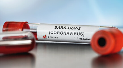 Sample vial with blood, label says SARS-CoV-2 coronavirus, positive result. Covid 19 testing during outbreak concept