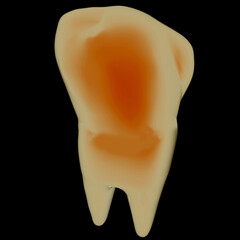 Tooth. 3d illustration. On a black background.